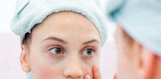 5 Ways to Deal With Dark Circles Before Your Wedding