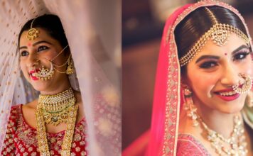 Get brighter and white teeth before your big day