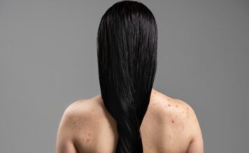 Get Rid Of Body Acne Before Your D-Day Get Rid Of Body Acne - Wedding Affair