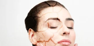 Top 4 Trusted Remedies for Brides with Dry Skin dry skin