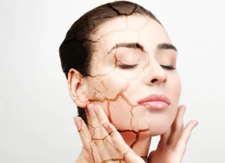 Top 4 Trusted Remedies for Brides with Dry Skin dry skin