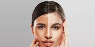 Easy Tricks to Avoid & Remove Summer Tan This Wedding Season Summer Tan