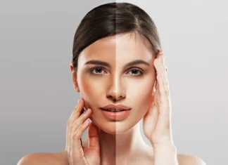 Easy Tricks to Avoid & Remove Summer Tan This Wedding Season Summer Tan