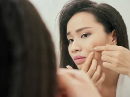 Skincare Mistakes