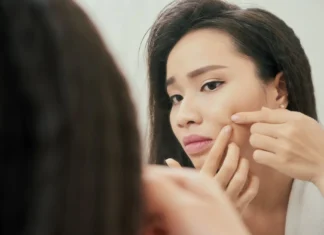 Major Skincare Mistakes Brides Make & How to Avoid Them! Skincare Mistakes