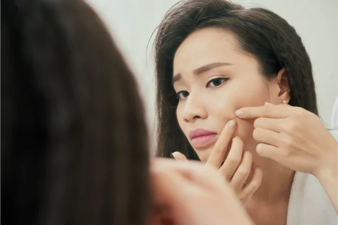 Skincare Mistakes